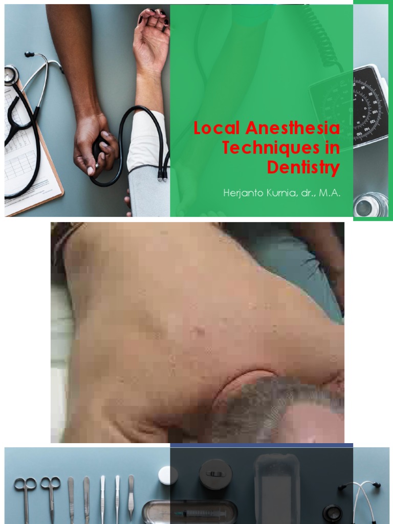 2 Local Anesthesia Techniques in Dentistry PDF