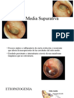 Otitis Media Crónica