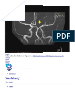 A1 Segment Hypoplasia - Radiology Case