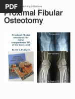 Articular Step-Off and Osteoarthritis Risk | PDF | Osteoarthritis | Knee