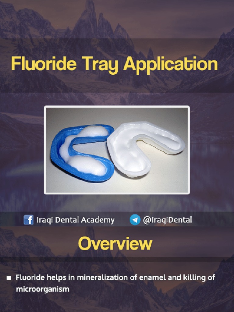 Fluoride Tray Application PDF
