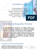 3.3 Electrocardiografia Normal