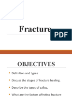 Fracture