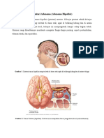 Pituitari Adenoma