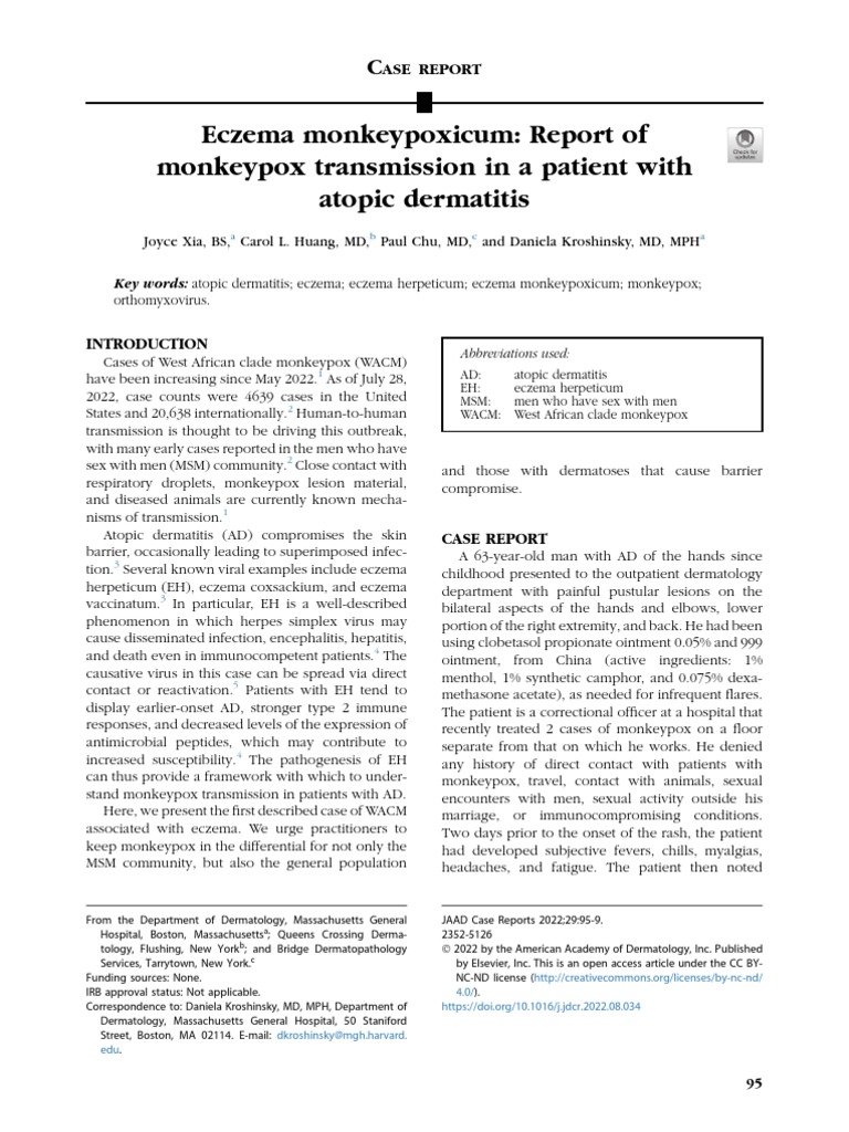 Eczema Monkeypoxicum Report of Monkeypox Transmission in A Patient With