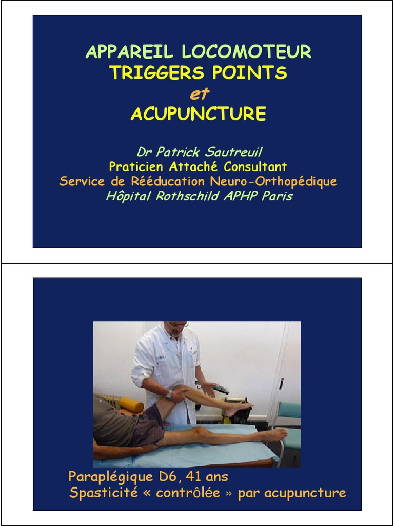 Triggers Points | PDF | Appareil locomoteur | Maladies et troubles