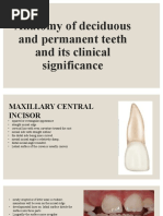 Anatomy of Maxillary Central Incisor | PDF | Dental Anatomy | Dentistry ...