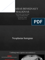 Neoplasias Benignas y Malignas