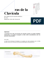 FX de Clavicula..