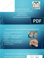 Eliminación de caries y restauraciones para acceso en línea recta en endodoncia