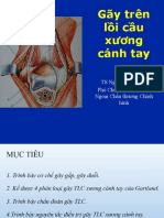 22. Gãy Trên Lồi Cầu Xương Cánh Tay