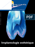 Implantologie Esthétique (PDFDrive)
