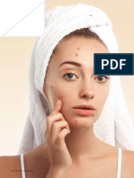 Cuidados com acne na puberdade