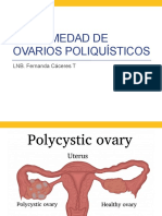 Enfermedad de Ovarios Poliquísticos: LNB. Fernanda Cáceres T