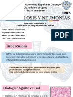 Tuberculocis Y NEUMONIA