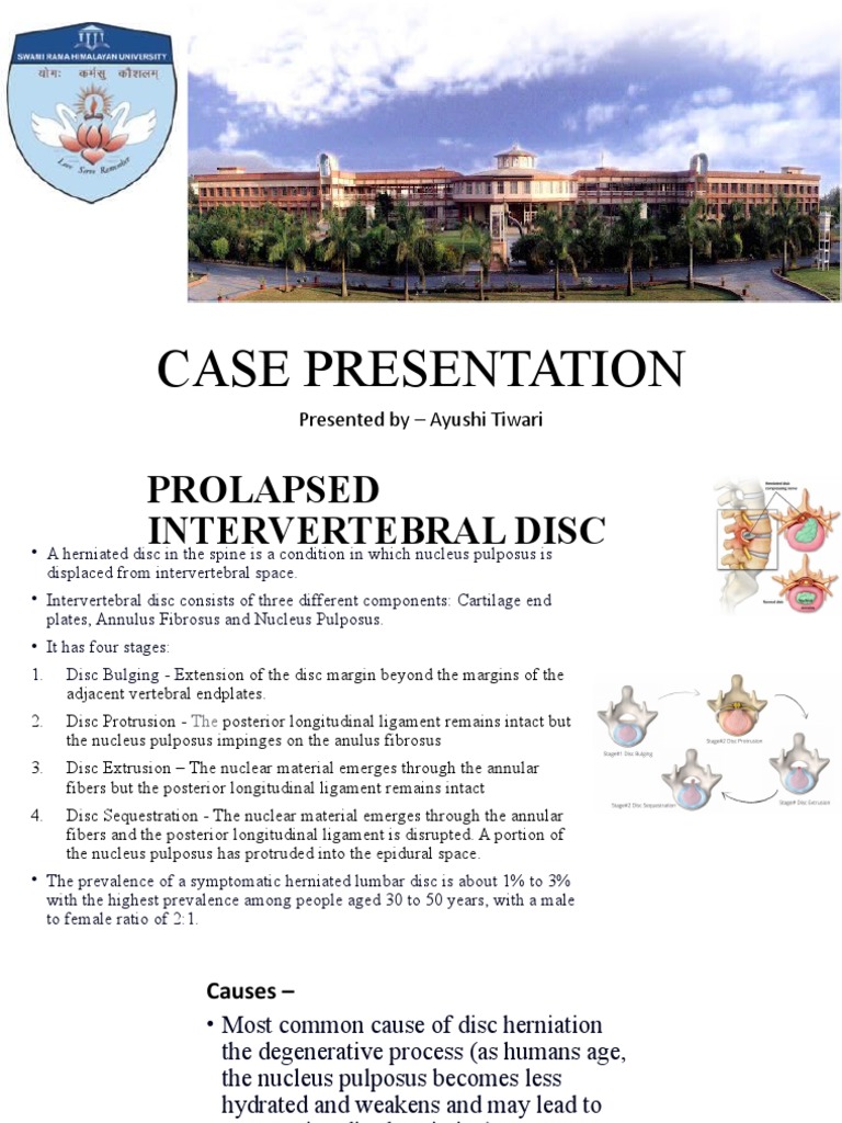 Stages and Management of PIVD | PDF | Musculoskeletal System | Clinical ...