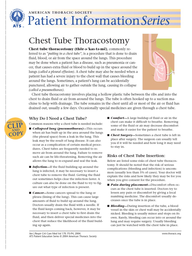 Chest Tube Thoracostomy PDF