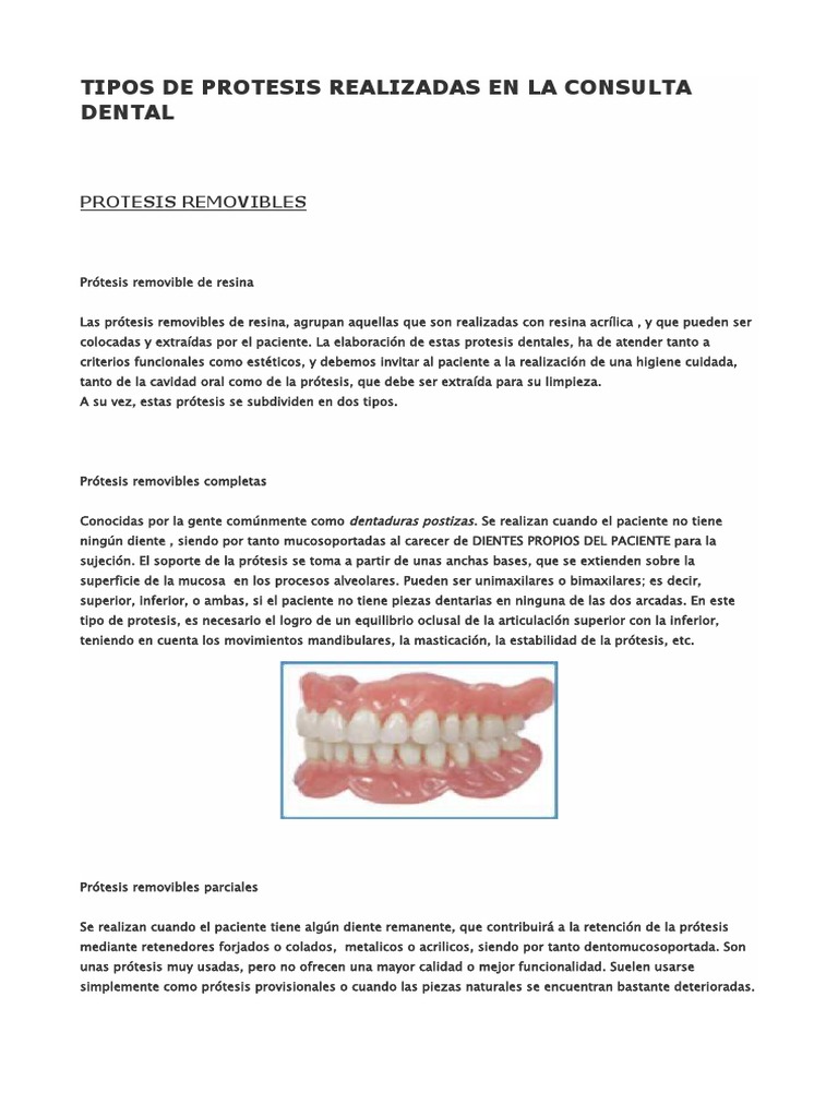 Tipos-De-Protesis en Consulta | PDF | Dentadura postiza | Implante dental