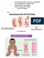 Invaginacion Intestinal