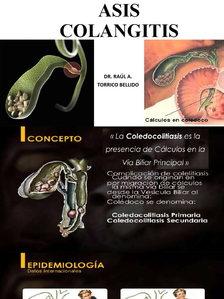 Coledocolitiasis - Colangitis | PDF