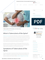 Tuberculosis of The Spine An Overview