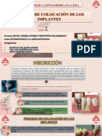 PROCESO DE COLOCACIÓN DE LOS IMPLANTES-completo