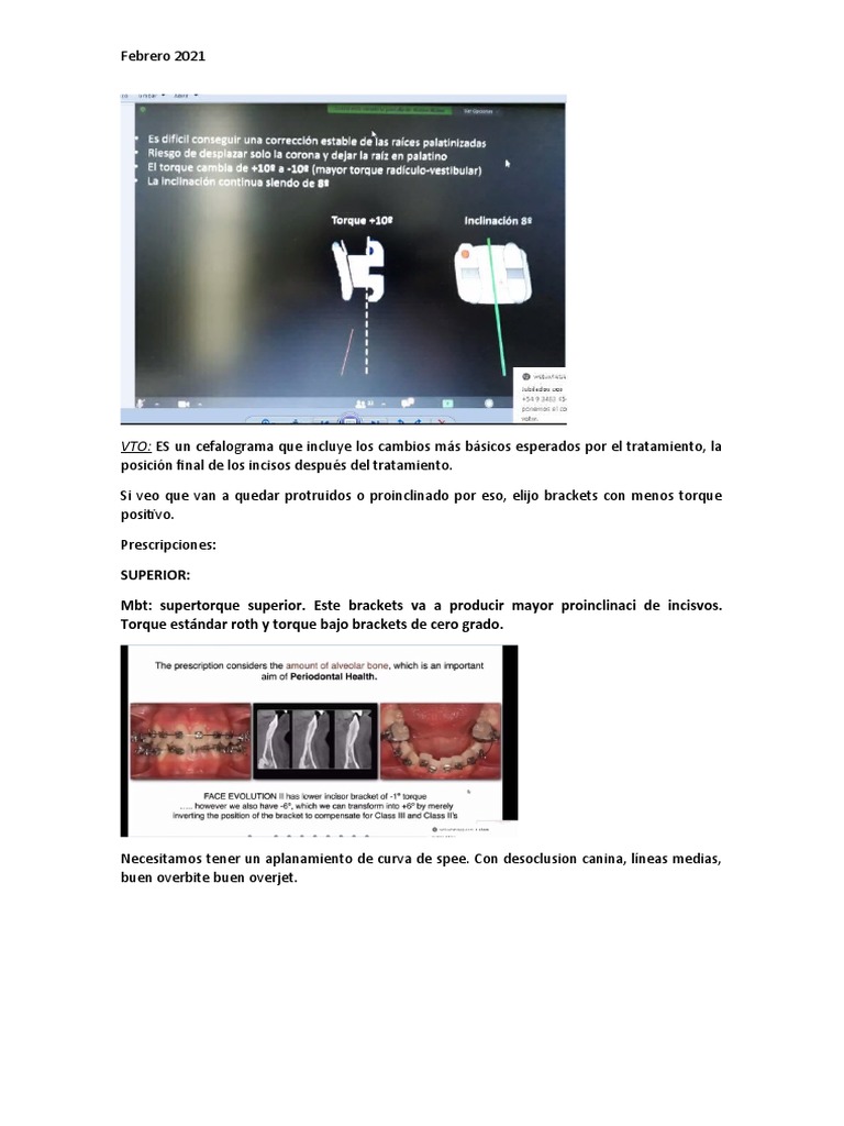 VTO ES Un Cefalograma Que Incluye Los Cambios Más Básicos Esperados