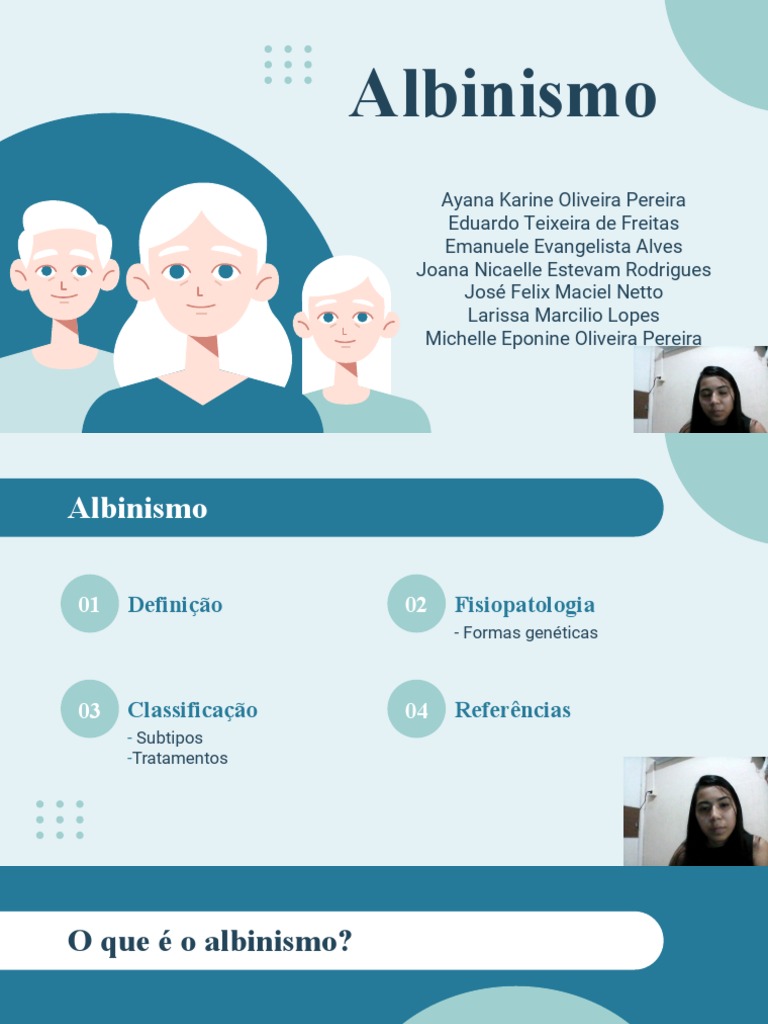A SUSCETIBILIDADE DO ALBINO AO CÂNCER DE PELE ALBINO'S SUSCEPTIBILITY TO  SKIN CANCER, image size:768x1024