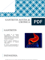 Gastritis Aguda & Crónica