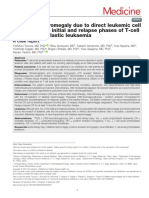 Bilateral Nephromegaly Due To Direct Leukemic Cell.149