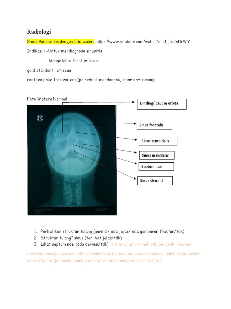 Rontgen Waters untuk Diagnosa Sinusitis | PDF
