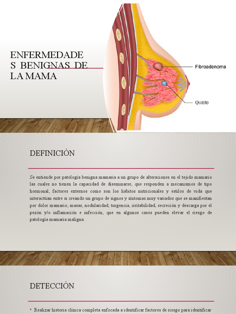 Enfermedades Benignas de La Mama y Cancer de Mama PDF Cáncer de