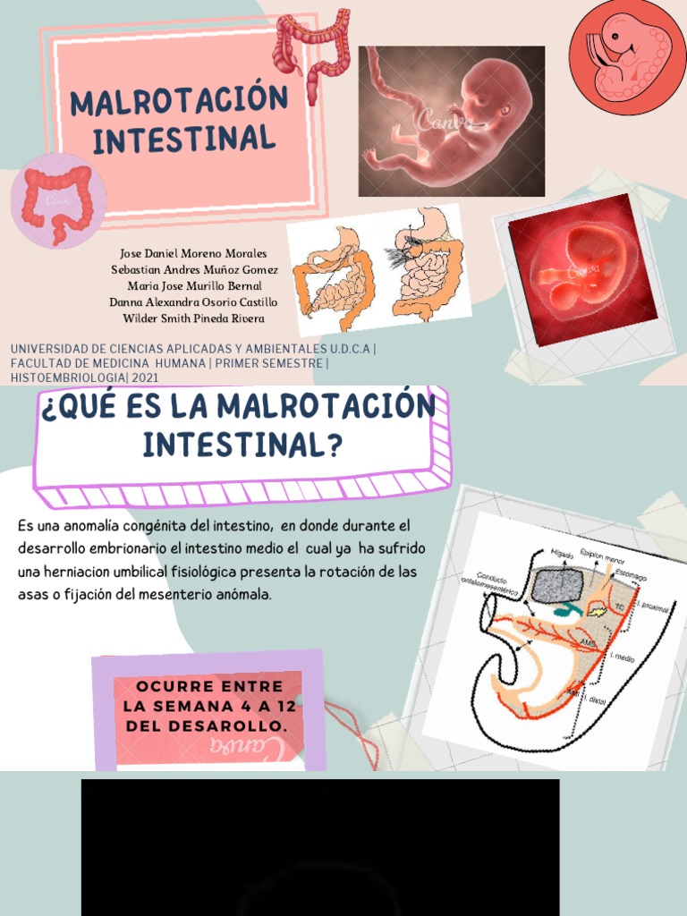 malrotaci-n-intestinal-diagn-stico-y-tratamiento-pdf-tracto