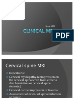 MRI Spine