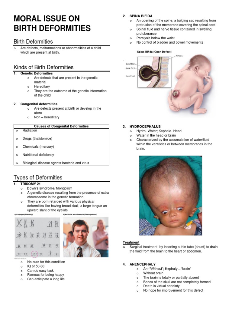Ethical Dilemmas of Birth Deformities | PDF | Human Diseases And ...