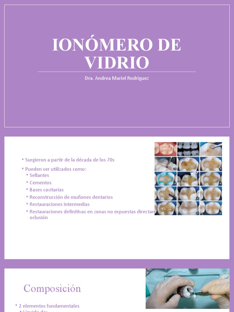 Ionómero de Vidrio | PDF | Lentes | Cemento