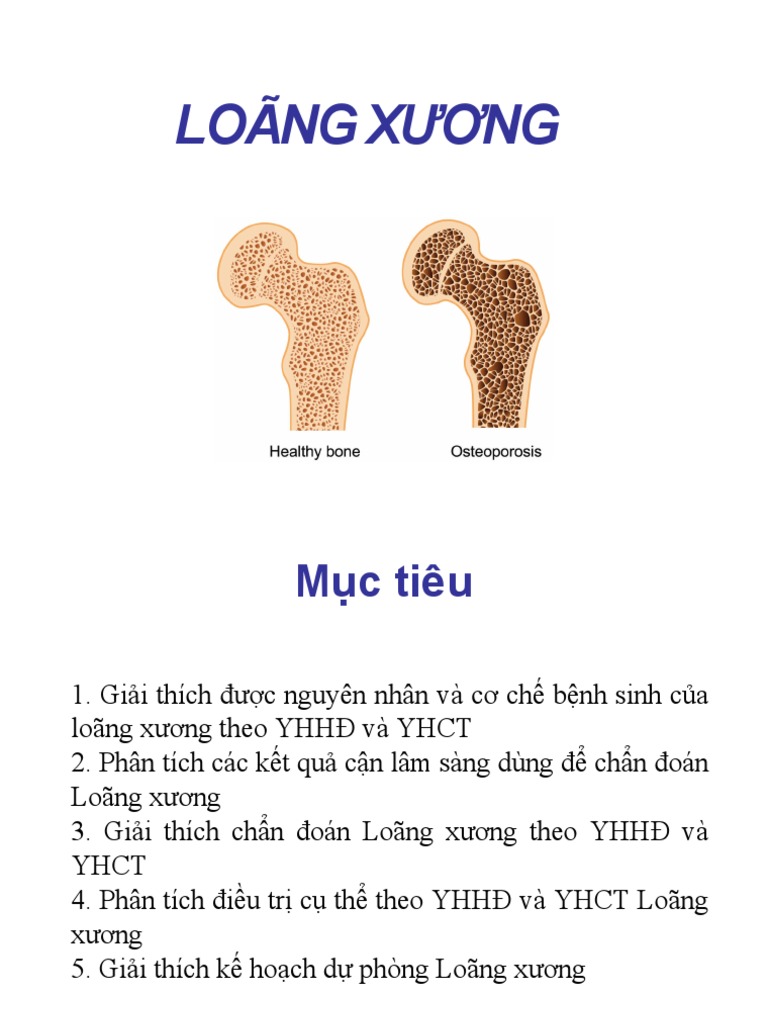 Loãng Xương 2022 | PDF