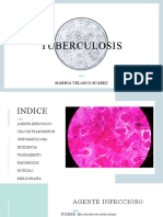 Tuberculosis