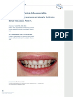 Full-Mouth Adhesive Rehabilitation of A Severely Eroded Dentition The Three-Step Technique. Part 1