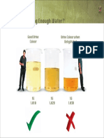 Are You Drinking Enough Water - Color Urine Chart English#DAD3