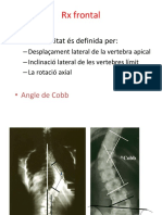 La Deformitat És Definida Per:: RX Frontal