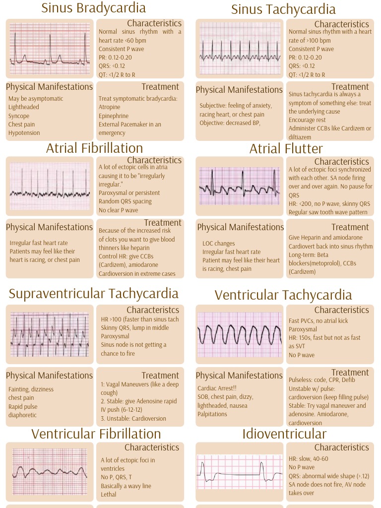 Finished Ekg Study Guide PDF Heart Heart Rate