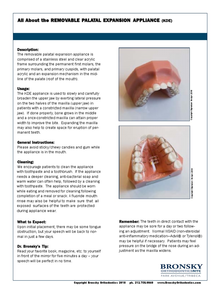 All About The REMOVABLE PALATAL EXPANSION APPLIANCE KDE PDF