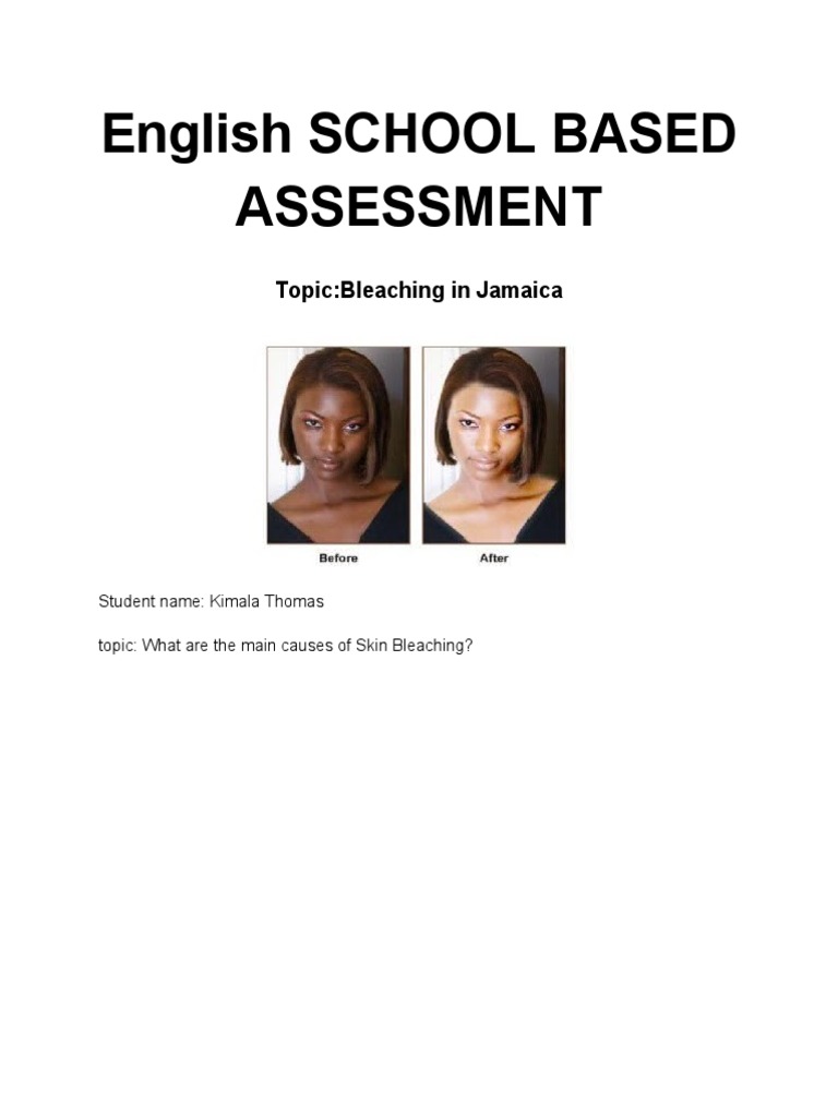 Causes of Skin Bleaching in Jamaica PDF Integumentary System Skin