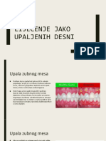 Lijecenje Upaljenih Desni