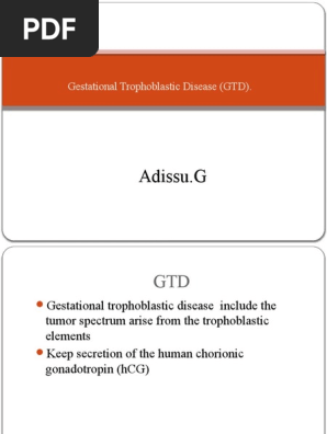 GTD