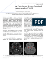 A Case Report On Pantothenate Kinase - Associated Neurodegeneration (PKAN)