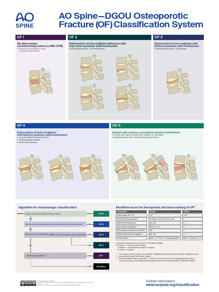 AO Spine Osteoporotic Classification Poster | PDF | Osteoporosis ...