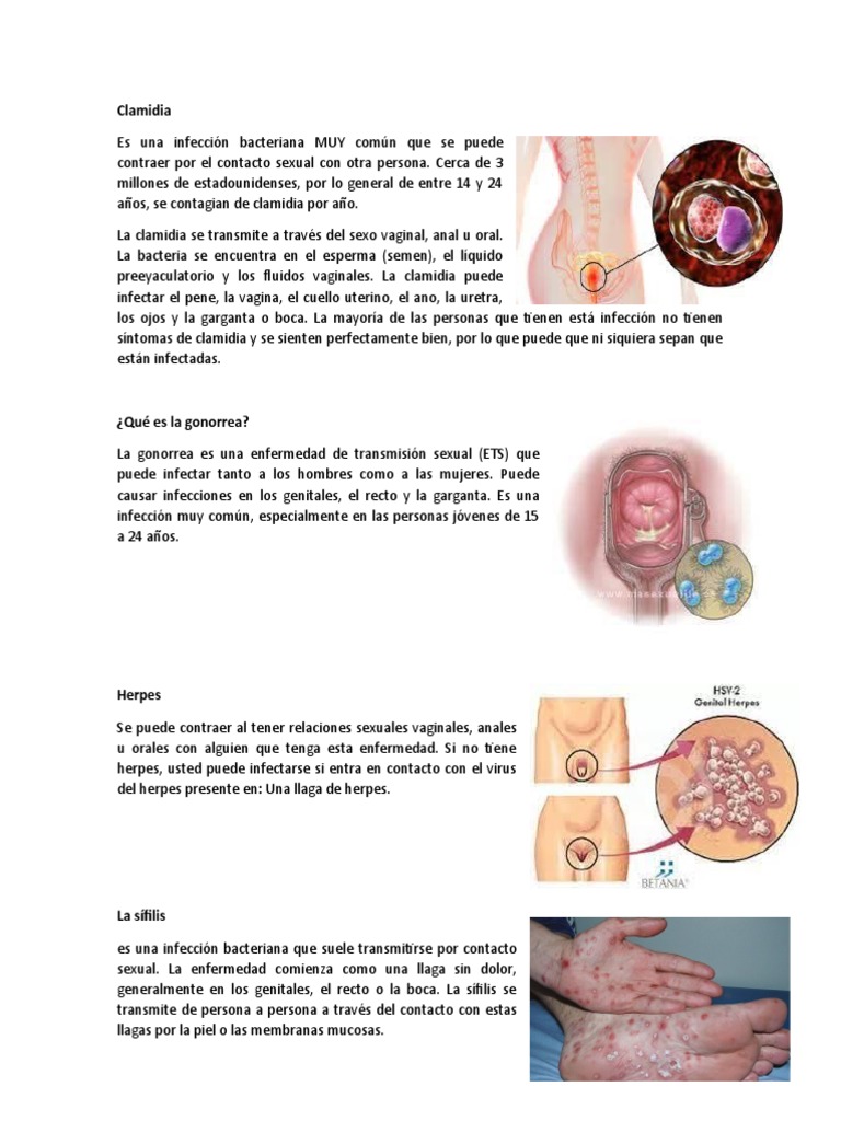 Clamidia | PDF