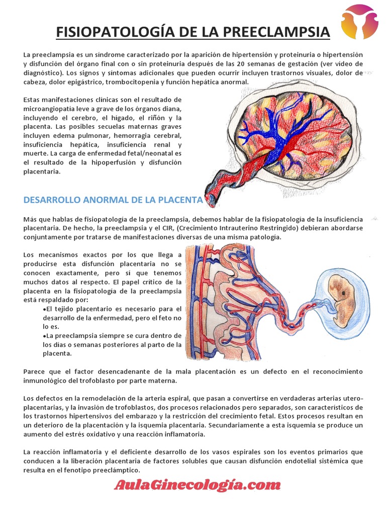 Fisiopatología de La Preeclampsia 2 | PDF | El embarazo | Placenta